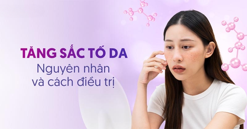 Tăng sắc tố da là gì? Biểu hiện, nguyên nhân và cách điều trị