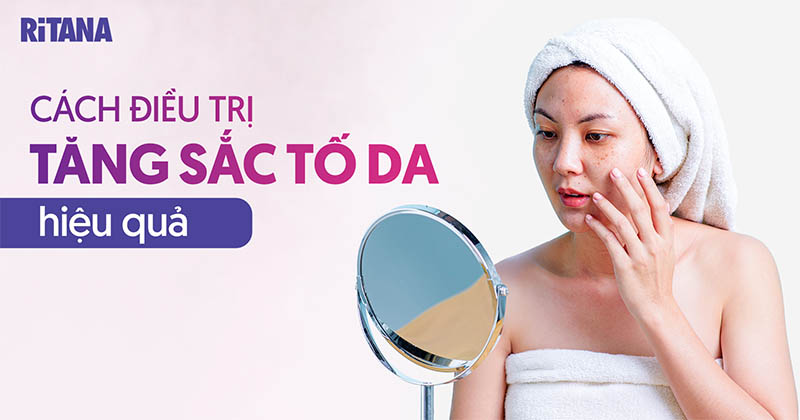 9 cách điều trị tăng sắc tố da tại nhà, mang lại làn da đều màu