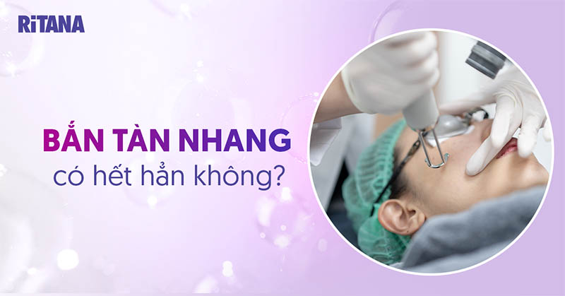 Bắn tàn nhang có hết hẳn không? Mấy lần thì khỏi hoàn toàn?
