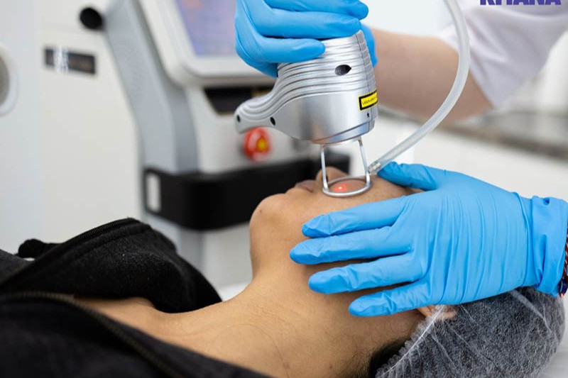 bắn tàn nhang mấy lần thì hết