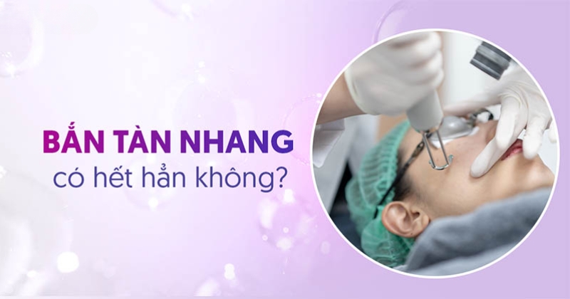 Bắn tàn nhang có hết hẳn không? Mấy lần thì khỏi hoàn toàn?
