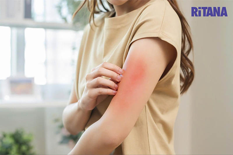 dị ứng sau khi uống glutathione