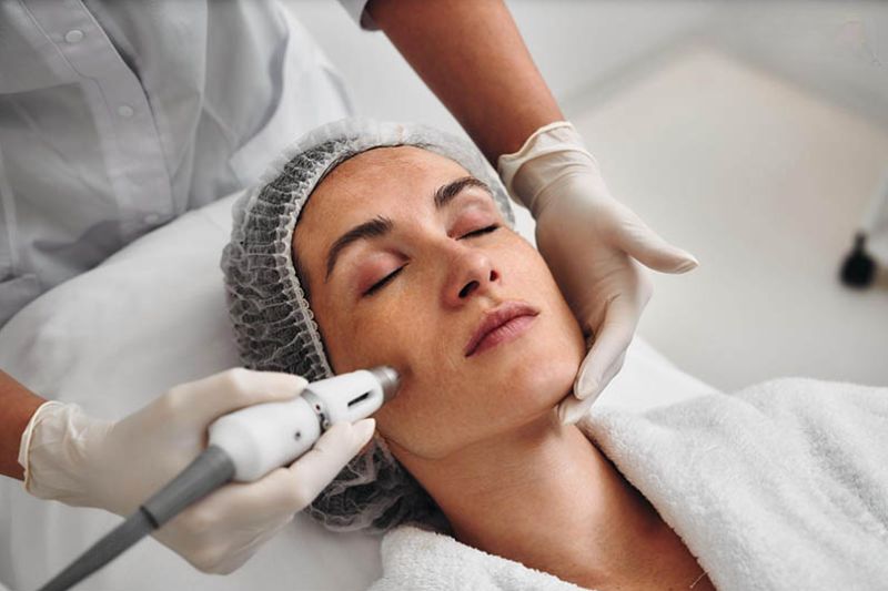 điều trị tăng sắc tố da bằng công nghệ cao