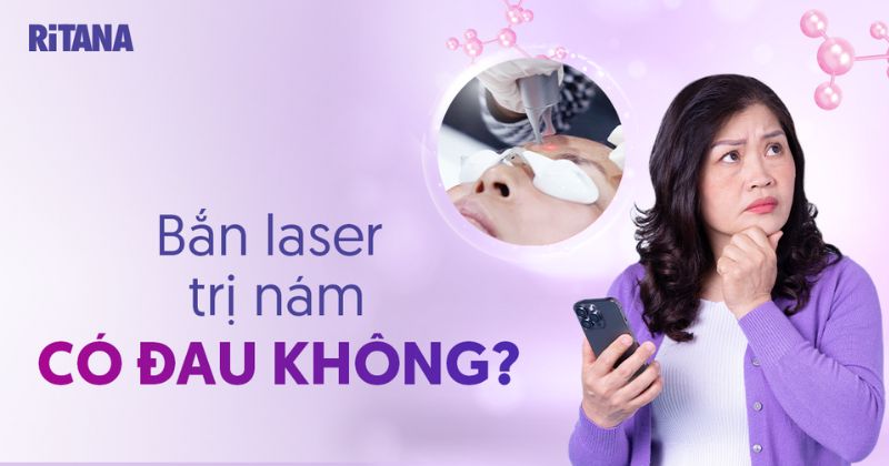 Bắn laser trị nám có đau không? Cần chuẩn bị những gì?