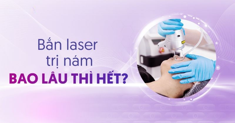 Bắn laser trị nám bao lâu thì hết? Hướng dẫn cách chăm sóc
