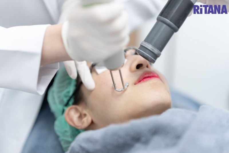 tuân thủ phác đồ điều trị nám 