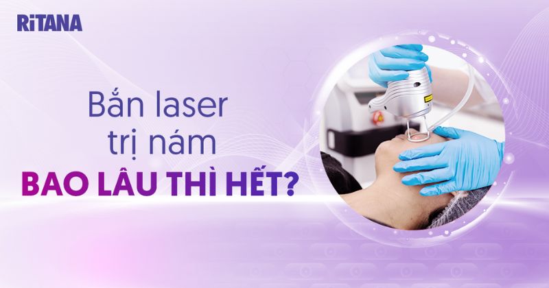 Bắn laser trị nám bao lâu thì hết? Hướng dẫn cách chăm sóc