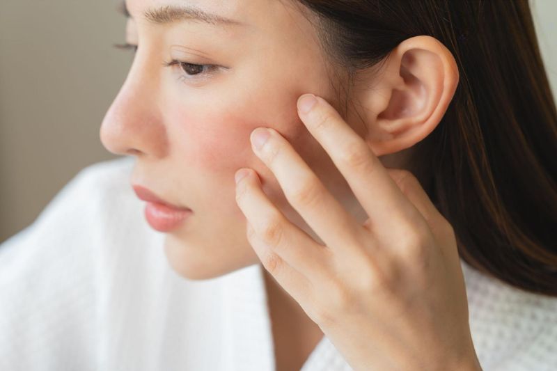 không chạm tay lên mặt sau khi tiêm meso