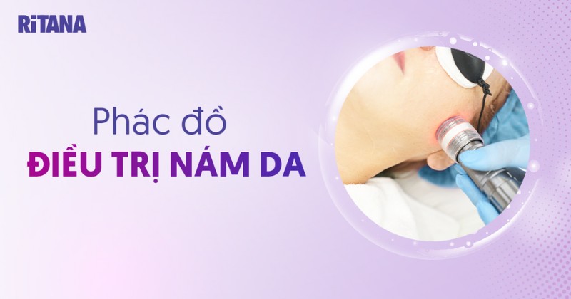 Thiết kế 4 phác đồ điều trị nám chi tiết cho từng phương pháp