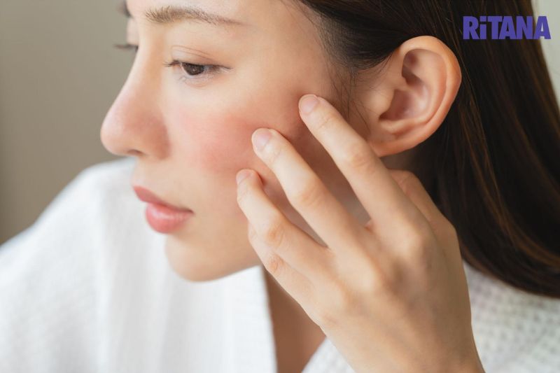 không chạm tay lên mặt sau khi tiêm meso
