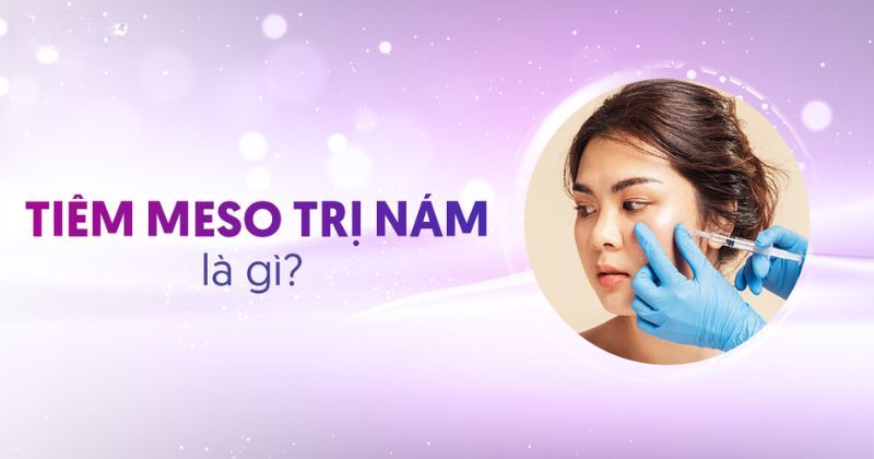 Tiêm Meso trị nám có hiệu quả không? Có nên thực hiện không?