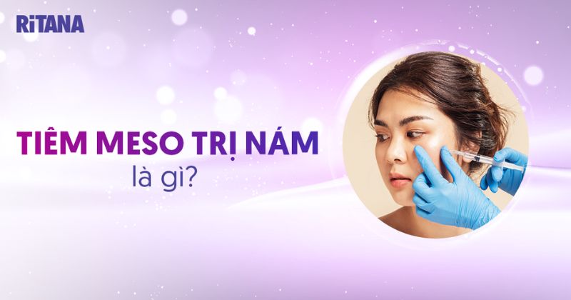 Tiêm Meso trị nám có hiệu quả không? Có nên thực hiện không?