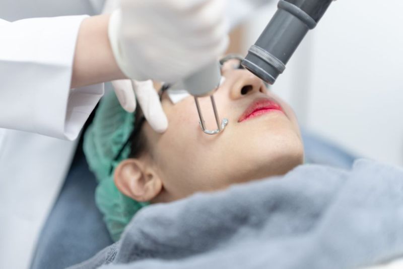 hết thâm sau trị nám phụ thuộc vào nhiều yếu tố