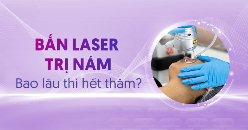 bắn laser trị nám bao lâu thì hết thâm