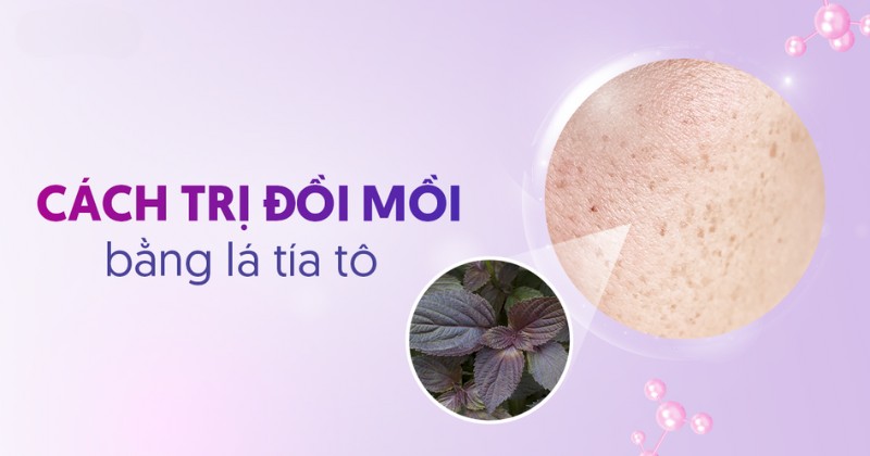 cách trị đồi mồi bằng lá tía tô