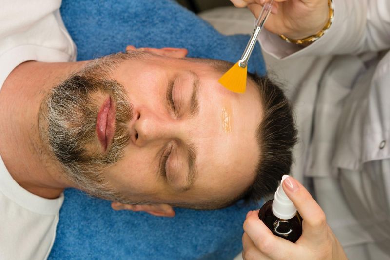 peel da hóa học cải thiện da xấu