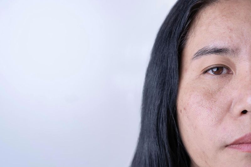 da không được cấp ẩm sẽ dễ làm da sạm đen