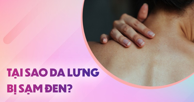 Tại sao da lưng bị sạm đen? Cách cải thiện và phòng ngừa