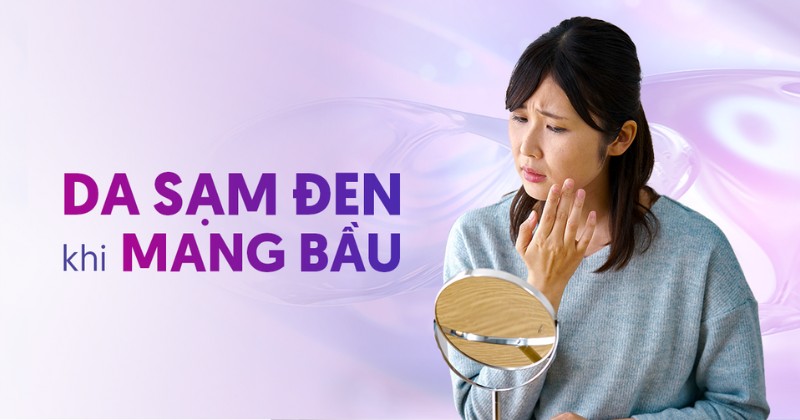Da sạm đen khi mang bầu trị như thế nào? Vì sao lại bị?
