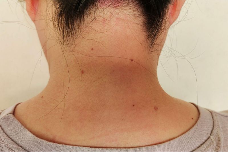 vùng da cổ có thể trắng lại nếu chăm sóc đúng cách