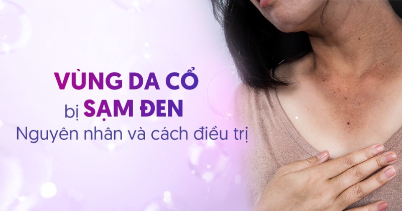 Nguyên nhân vùng da cổ bị sạm đen và bài toán khắc phục