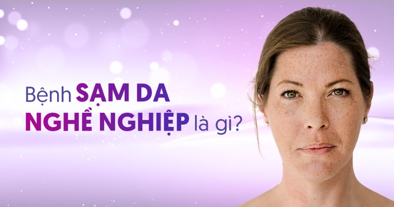 Bệnh sạm da nghề nghiệp và giải pháp khắc phục