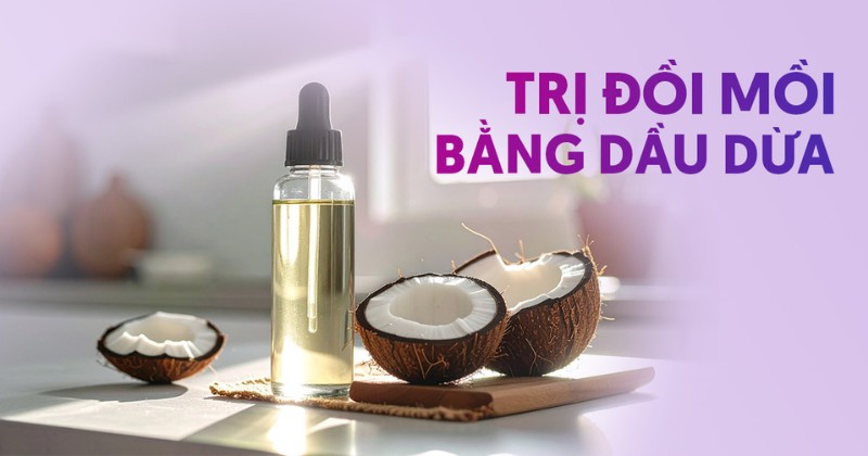 8 cách trị đồi mồi bằng dầu dừa đơn giản hữu hiệu