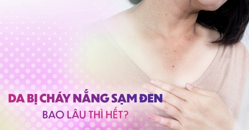 Làn da bị cháy nắng sạm đen bao lâu thì hết?