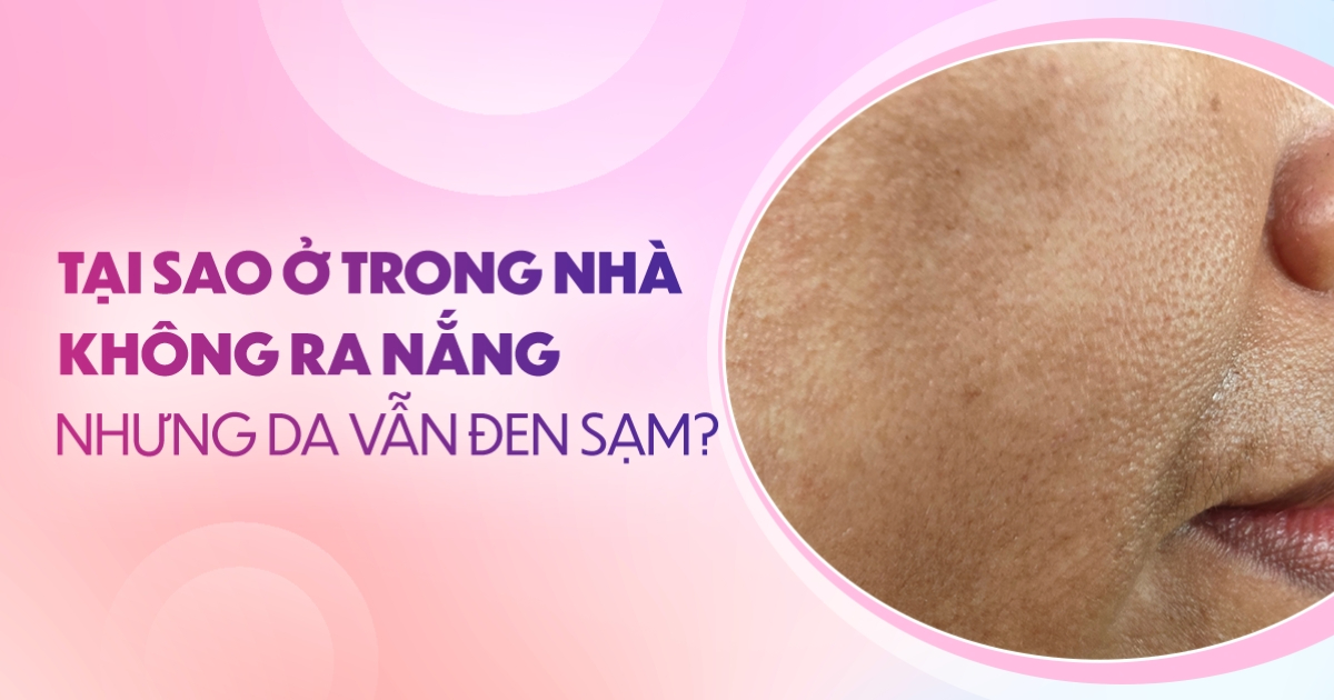 Tại sao ở trong nhà không ra nắng nhưng da vẫn đen sạm?