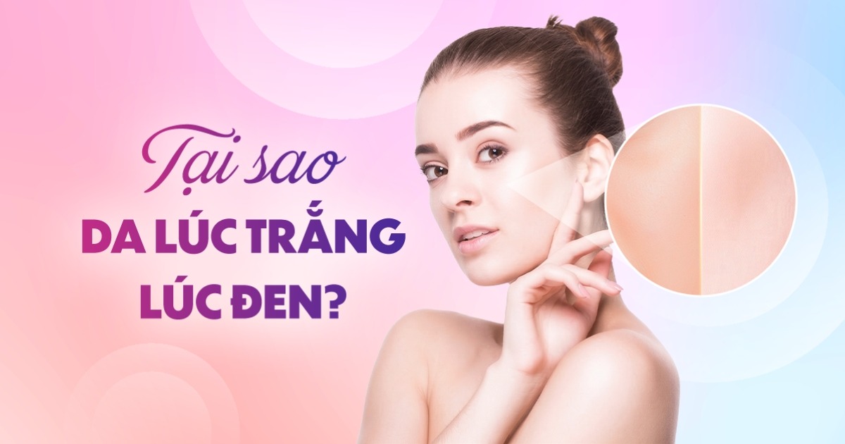 Tại sao da lúc trắng lúc đen? Phải xử lý thế nào?