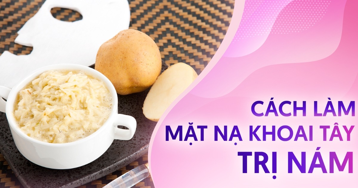 10 cách làm mặt nạ khoai tây trị nám ở nhà và lưu ý cần biết