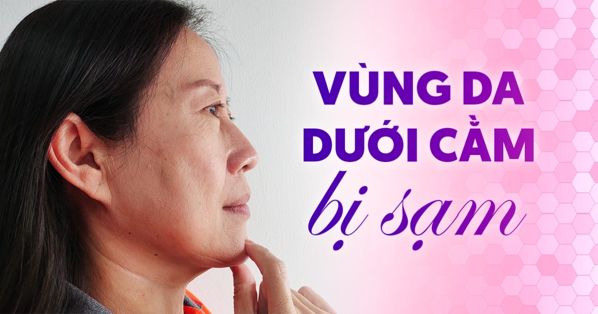 Căn nguyên làm vùng da dưới cằm bị sạm và cách khắc phục
