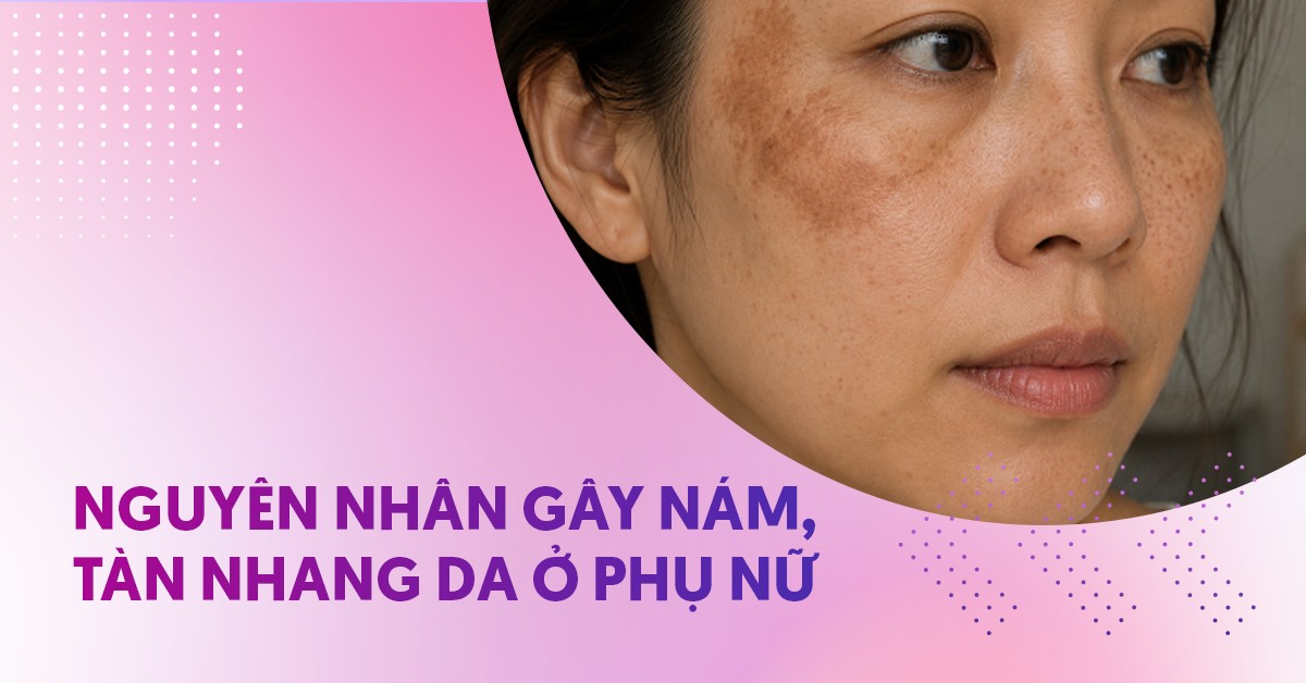 11 nguyên nhân gây nám tàn nhang ở phụ nữ phổ biến